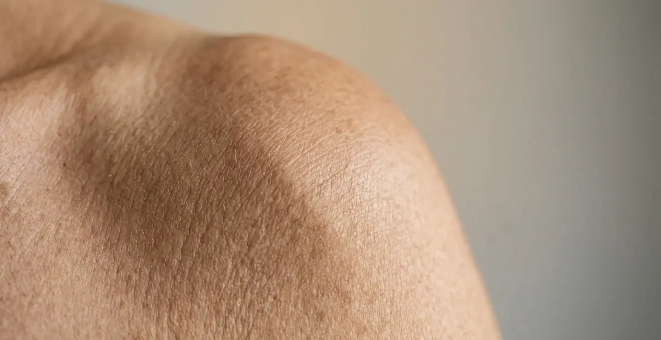 Close-up of an aging shoulder joint showing natural structural changes in connective tissue without text or diagrams